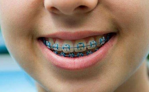 孩子进行牙齿矫正的最好时期