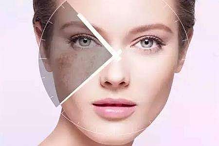 女性脸部长斑点？不同位置可能代表不同身体疾病出现