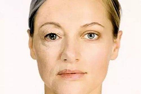 卸妆减少的肌肤问题，比你的护肤产品有用多了