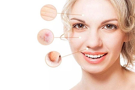 女性面部皮肤下垂怎么办，四个方法延缓衰老