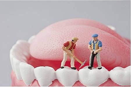 洗牙对牙齿有伤害吗，洗牙的注意事项有哪些