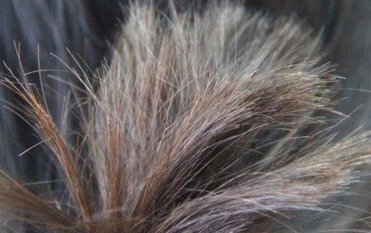 头皮油发尾干是什么发质
