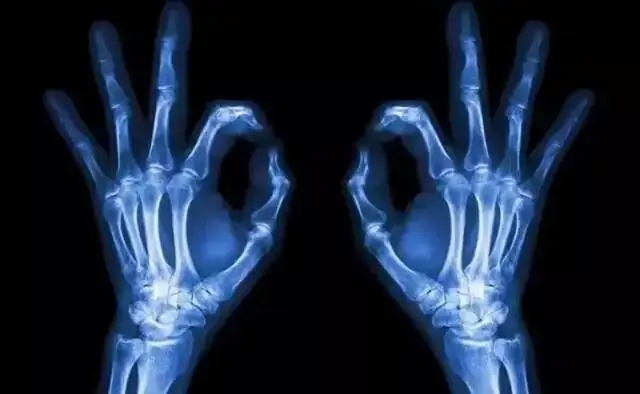 X射线为什么能拍出骨头的照片
